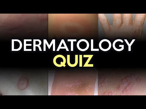 Dermatology Quiz