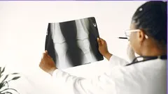 Radiographic (X-RAY) Positioning Made Easy: LOWER EXTREMITY